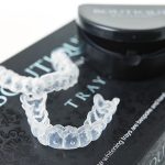 Boutique Teeth Whitening Cheshire