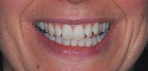 Before Enlighten Before Enlighten
